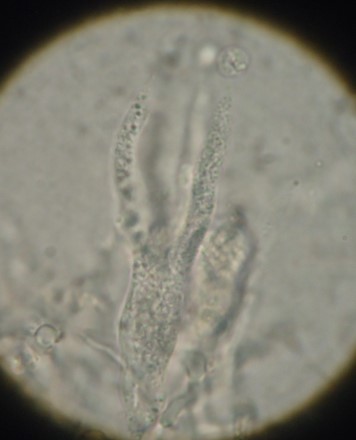 Tanti dubbi (Heteroradulum deglubens)